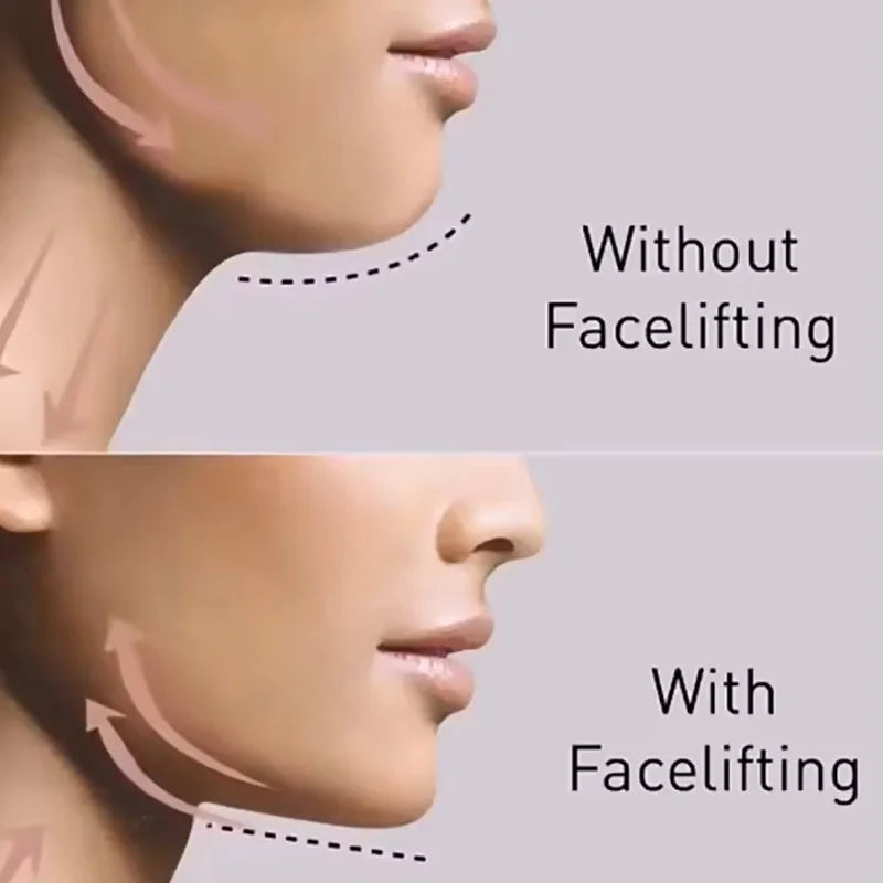 Portable Facial Lifting Laser Machine 980nm 1470nm Body Skin Tightening
