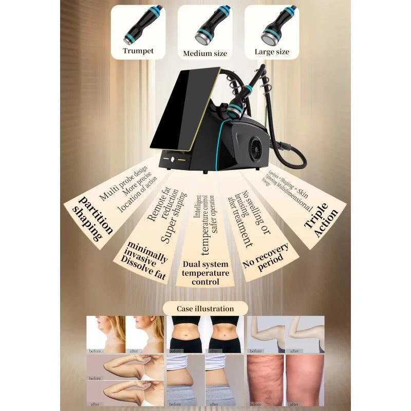 Ice Microwave 2.45GHz Skin Tightening Machine for Body Contouring